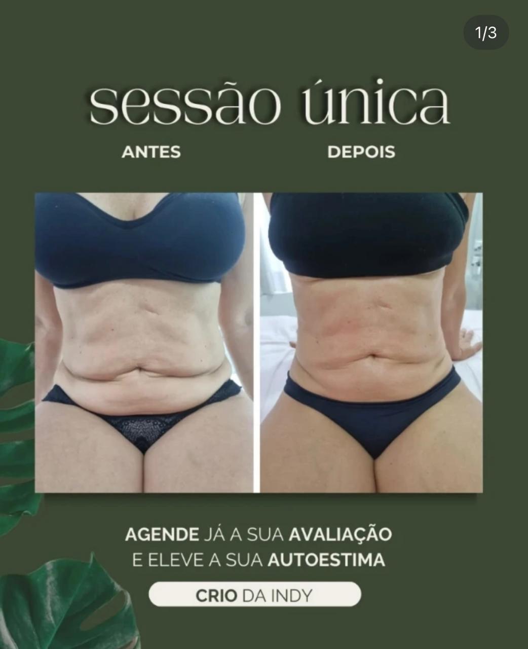Método Crio da Indi - Caso 6